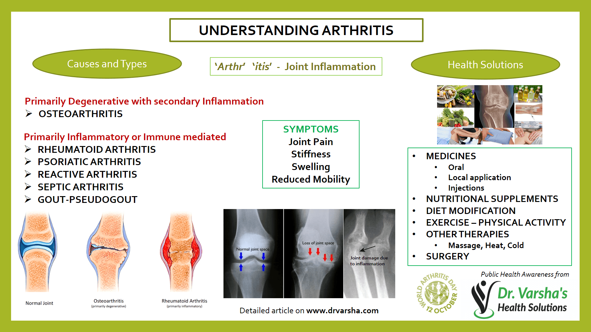 Arthritis   Arthritis 