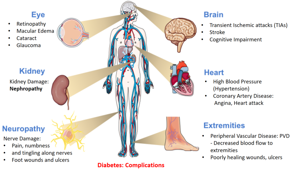 Diabetes Awareness Health Risks, Holistic treatment and care
