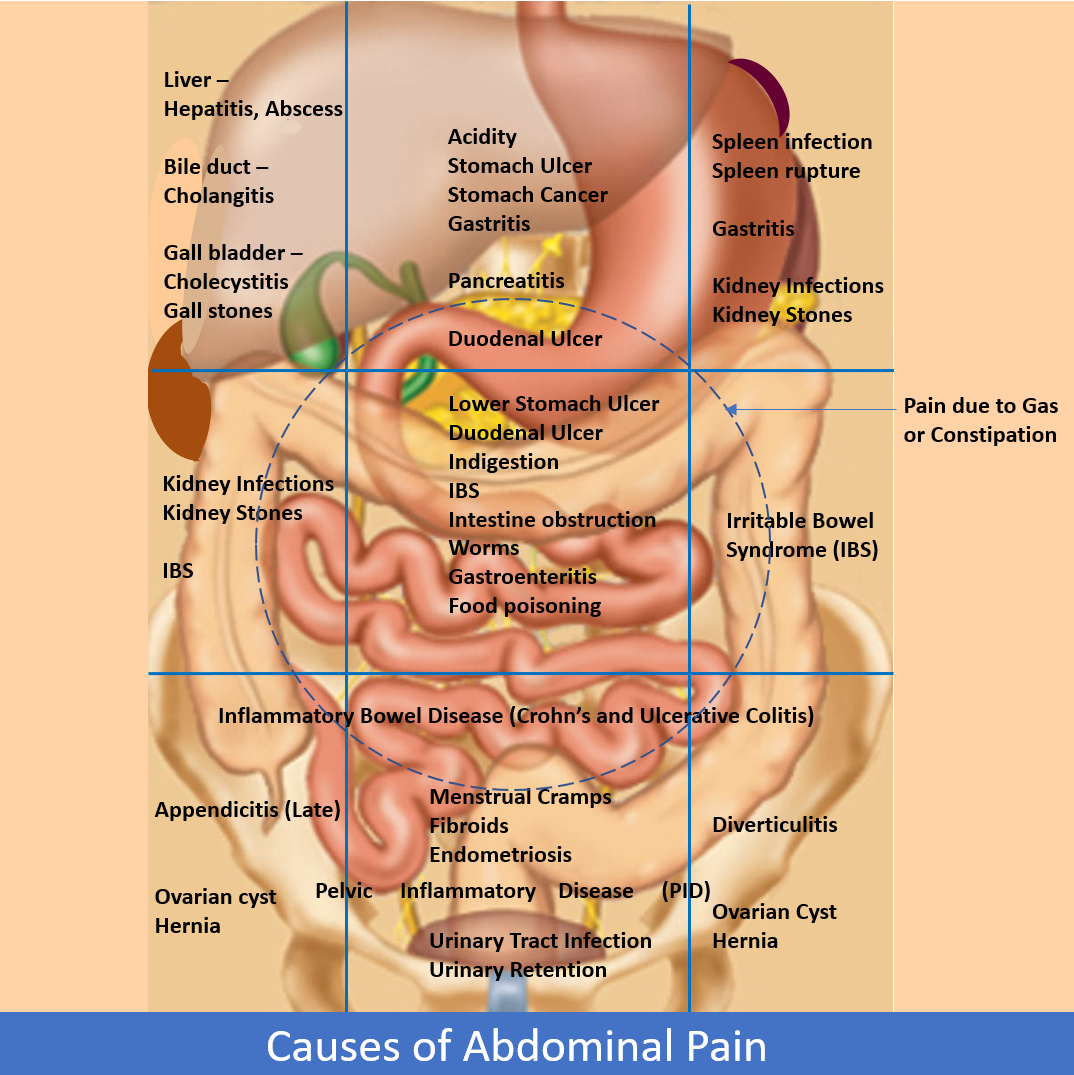 right-abdominal-pain