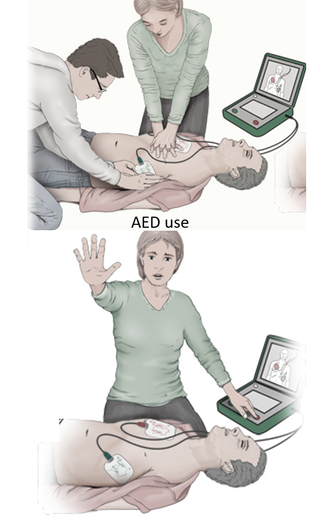 AED use