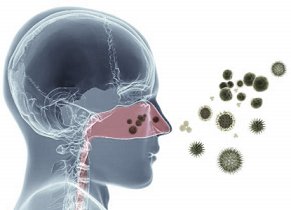 Allergic Rhinitis