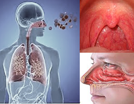 Respiratory Tract Diseases