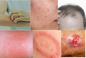 Skin and Hair Diseases