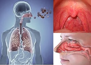 Respiratory Tract Diseases