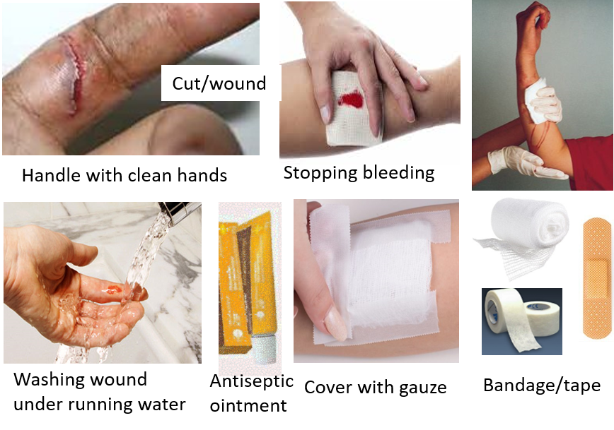 First aid for cuts