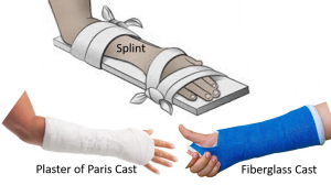 Fracture first aid