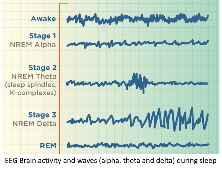 Understanding And Recognizing Sleep Disorders