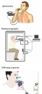 Pulmonary Function Tests (PFT) - Overview and Understanding