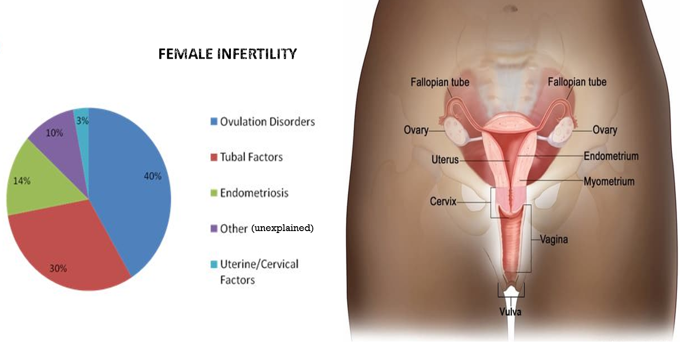 causes of female infertility