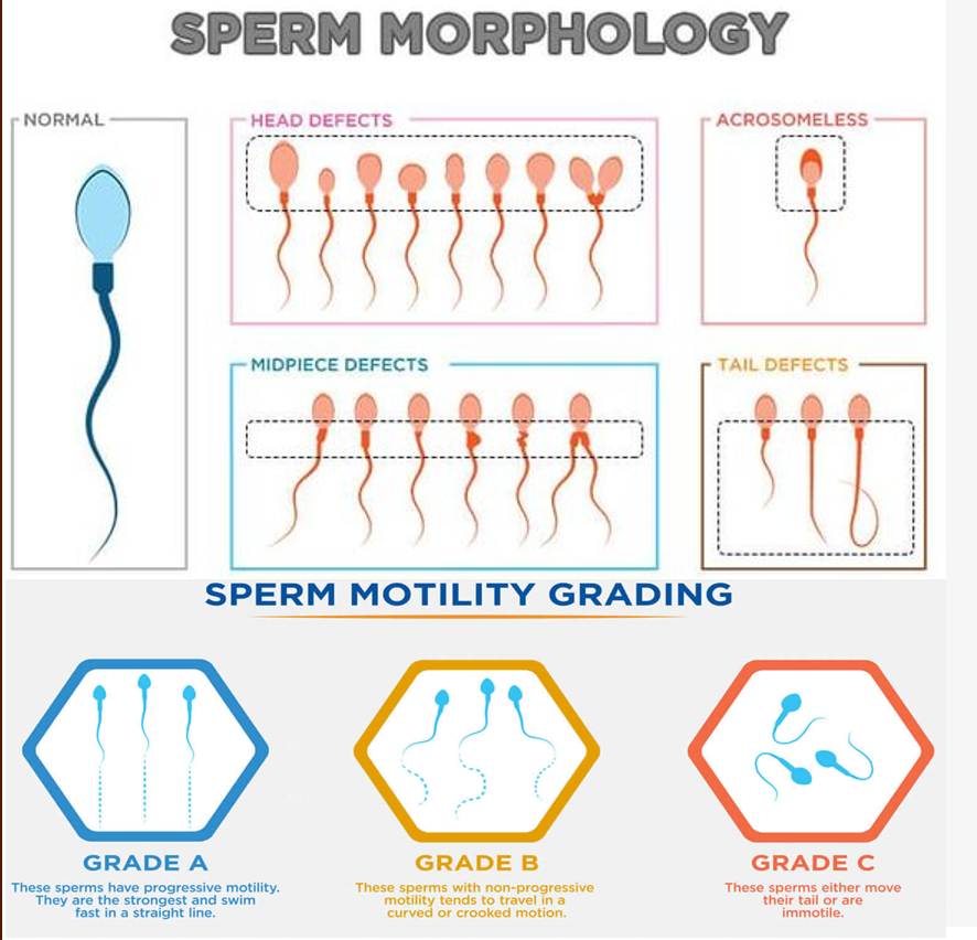 sperm shape and structure