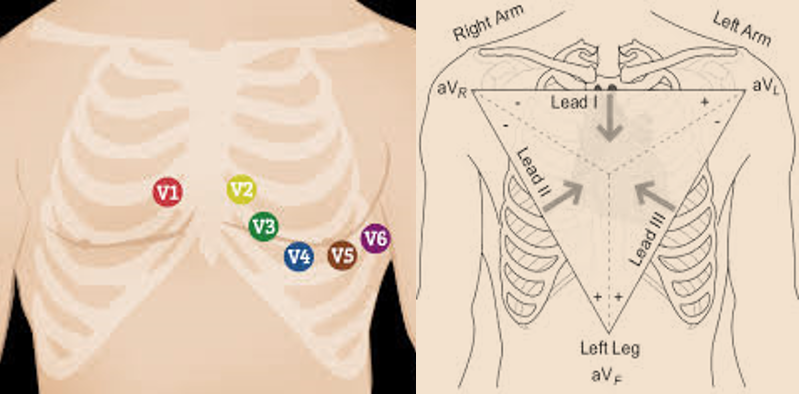 ECG leads