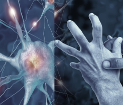 Parkinson's disease